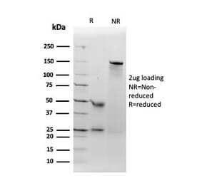 SDS-PAGE - Anti-Angiotensin Converting Enzyme 1 Antibody [ACE/3762] - BSA and Azide free (A251509) - Antibodies.com