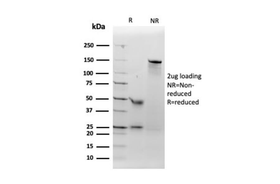 SDS-PAGE - Anti-Angiotensin Converting Enzyme 1 Antibody [ACE/3762] - BSA and Azide free (A251509) - Antibodies.com