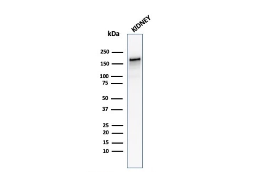 Western Blot - Anti-Angiotensin Converting Enzyme 1 Antibody [ACE/3762] - BSA and Azide free (A251509) - Antibodies.com