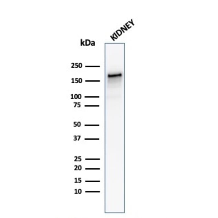 Western Blot - Anti-Angiotensin Converting Enzyme 1 Antibody [ACE/3762] - BSA and Azide free (A251509) - Antibodies.com