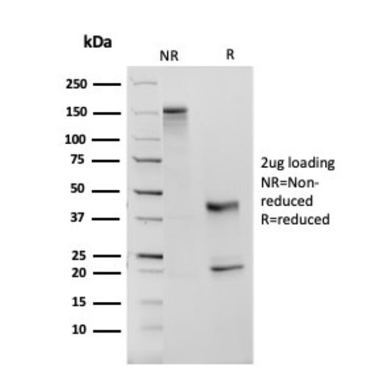 SDS-PAGE - Anti-Angiotensin Converting Enzyme 1 Antibody [ACE/3763] - BSA and Azide free (A251510) - Antibodies.com