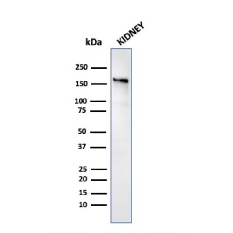 Western Blot - Anti-Angiotensin Converting Enzyme 1 Antibody [ACE/3763] - BSA and Azide free (A251510) - Antibodies.com