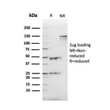 SDS-PAGE - Anti-Angiotensin Converting Enzyme 1 Antibody [ACE/3765] - BSA and Azide free (A251511) - Antibodies.com