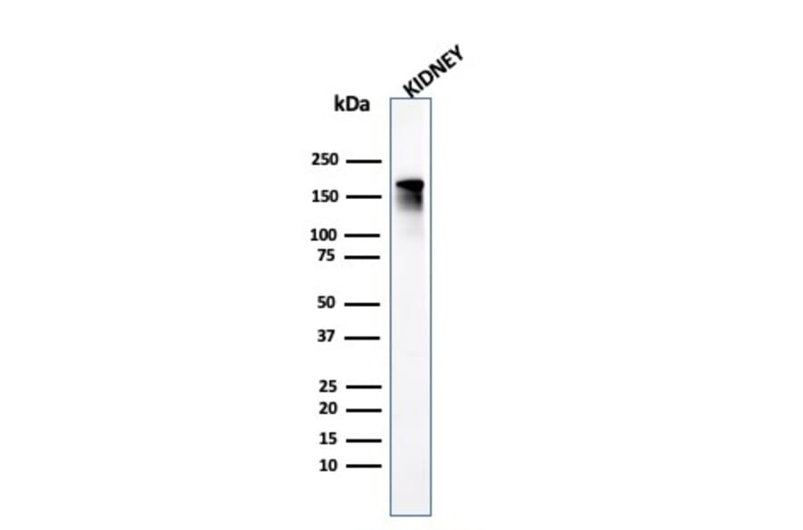 Western Blot - Anti-Angiotensin Converting Enzyme 1 Antibody [ACE/3765] - BSA and Azide free (A251511) - Antibodies.com