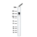 Western Blot - Anti-Angiotensin Converting Enzyme 1 Antibody [ACE/3765] - BSA and Azide free (A251511) - Antibodies.com