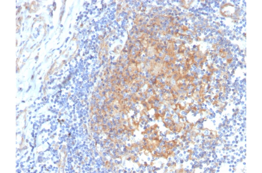 Immunohistochemistry - Anti-AKR1C1 Antibody [CPTC-AKR1C1-2] - BSA and Azide free (A251512) - Antibodies.com