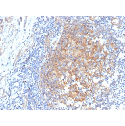 Immunohistochemistry - Anti-AKR1C1 Antibody [CPTC-AKR1C1-2] - BSA and Azide free (A251512) - Antibodies.com