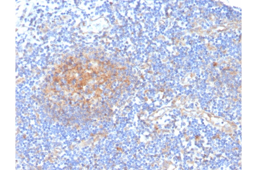 Immunohistochemistry - Anti-AKR1C1 Antibody [CPTC-AKR1C1-2] - BSA and Azide free (A251511) - Antibodies.com