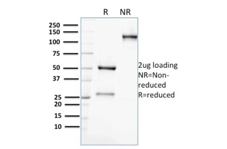 SDS-PAGE - Anti-AKR1C2 Antibody [CPTC-AKR1C2-1] - BSA and Azide free (A251513) - Antibodies.com