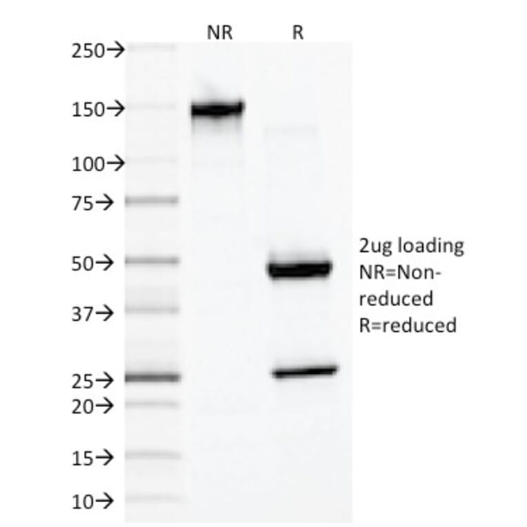 SDS-PAGE - Anti-Desmin Antibody [DES/1711] - BSA and Azide free (A251514) - Antibodies.com