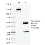SDS-PAGE - Anti-Desmin Antibody [DES/1711] - BSA and Azide free (A251514) - Antibodies.com
