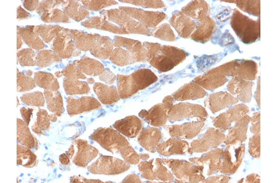Immunohistochemistry - Anti-Desmin Antibody [DES/2960R] - BSA and Azide free (A251515) - Antibodies.com
