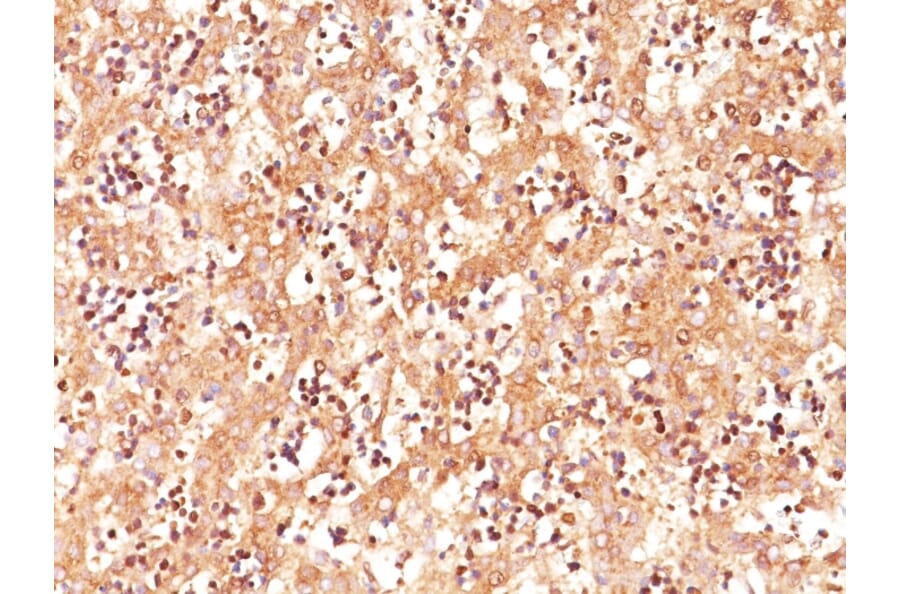 Immunohistochemistry - Anti-alpha Fetoprotein Antibody [C3] - BSA and Azide free (A251516) - Antibodies.com