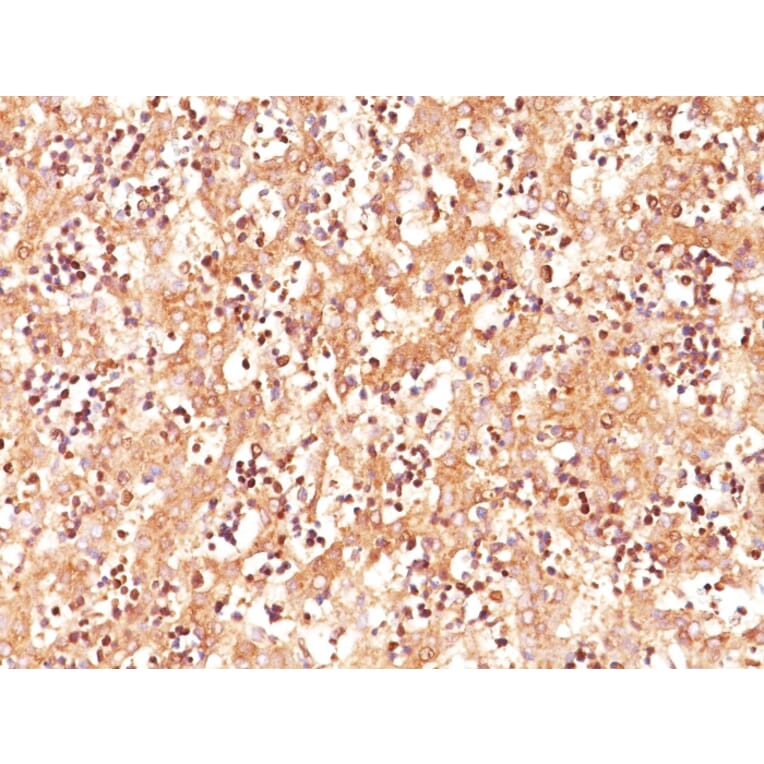 Immunohistochemistry - Anti-alpha Fetoprotein Antibody [C3] - BSA and Azide free (A251516) - Antibodies.com