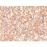 Immunohistochemistry - Anti-alpha Fetoprotein Antibody [C3] - BSA and Azide free (A251516) - Antibodies.com