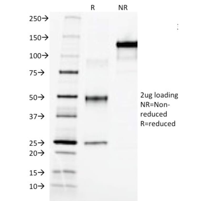 SDS-PAGE - Anti-alpha Fetoprotein Antibody [C3] - BSA and Azide free (A251517) - Antibodies.com