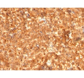 Immunohistochemistry - Anti-alpha Fetoprotein Antibody [C2 + C3 + MBS-12] - BSA and Azide free (A251519) - Antibodies.com