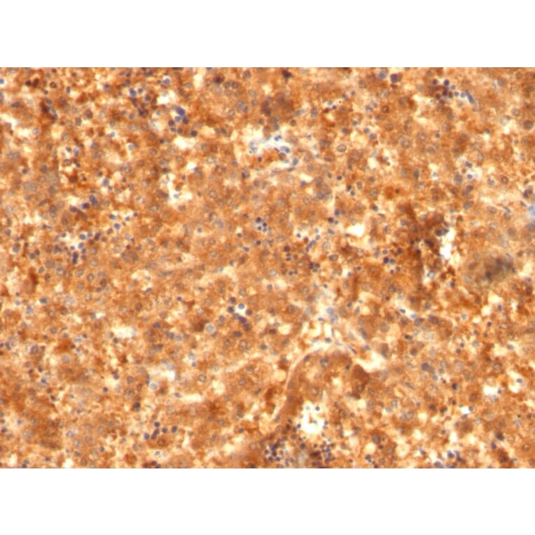 Immunohistochemistry - Anti-alpha Fetoprotein Antibody [C2 + C3 + MBS-12] - BSA and Azide free (A248337) - Antibodies.com