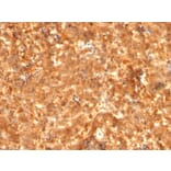 Immunohistochemistry - Anti-alpha Fetoprotein Antibody [C2 + C3 + MBS-12] - BSA and Azide free (A248337) - Antibodies.com