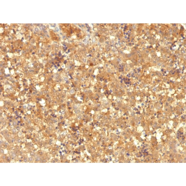 Immunohistochemistry - Anti-alpha Fetoprotein Antibody [MBS-12] - BSA and Azide free (A251519) - Antibodies.com