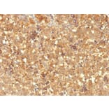 Immunohistochemistry - Anti-alpha Fetoprotein Antibody [MBS-12] - BSA and Azide free (A251519) - Antibodies.com