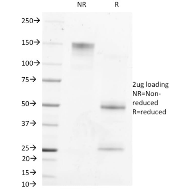 SDS-PAGE - Anti-alpha Fetoprotein Antibody [MBS-12] - BSA and Azide free (A251520) - Antibodies.com