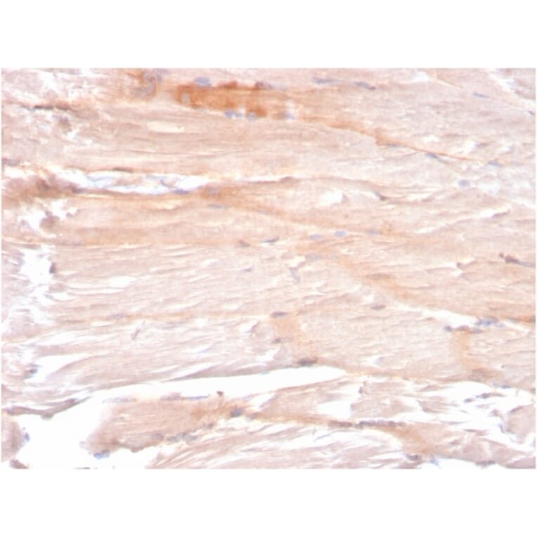 Immunohistochemistry - Anti-Dystrophin Antibody [DMD/3241] - BSA and Azide free (A251522) - Antibodies.com