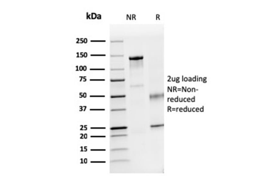 SDS-PAGE - Anti-Dystrophin Antibody [DMD/3241] - BSA and Azide free (A251522) - Antibodies.com