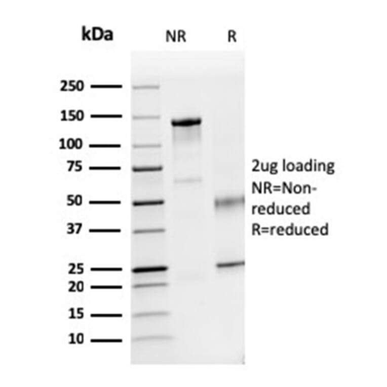 SDS-PAGE - Anti-Dystrophin Antibody [DMD/3241] - BSA and Azide free (A251522) - Antibodies.com