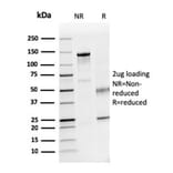 SDS-PAGE - Anti-Dystrophin Antibody [DMD/3241] - BSA and Azide free (A251522) - Antibodies.com