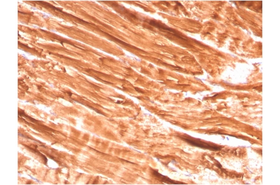 Immunohistochemistry - Anti-Dystrophin Antibody [DMD/3242] - BSA and Azide free (A251523) - Antibodies.com