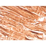 Immunohistochemistry - Anti-Dystrophin Antibody [DMD/3242] - BSA and Azide free (A251523) - Antibodies.com