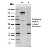 SDS-PAGE - Anti-Dystrophin Antibody [DMD/3242] - BSA and Azide free (A251523) - Antibodies.com