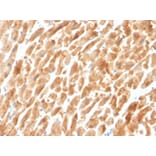 Immunohistochemistry - Anti-Dystrophin Antibody [DMD/3242] - BSA and Azide free (A251523) - Antibodies.com