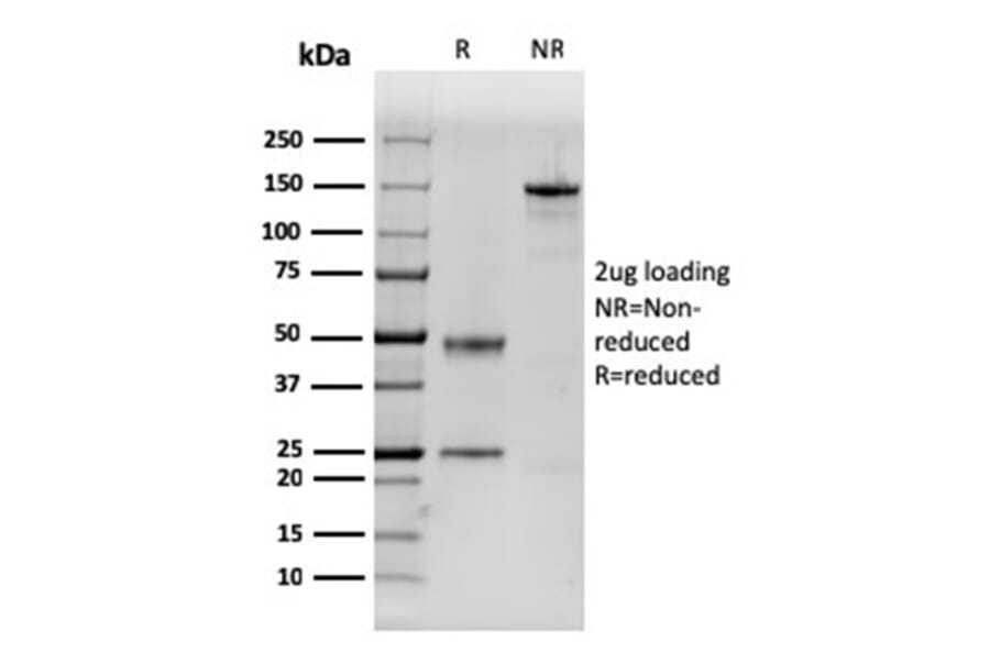 SDS-PAGE - Anti-Dystrophin Antibody [DMD/3243] - BSA and Azide free (A251524) - Antibodies.com