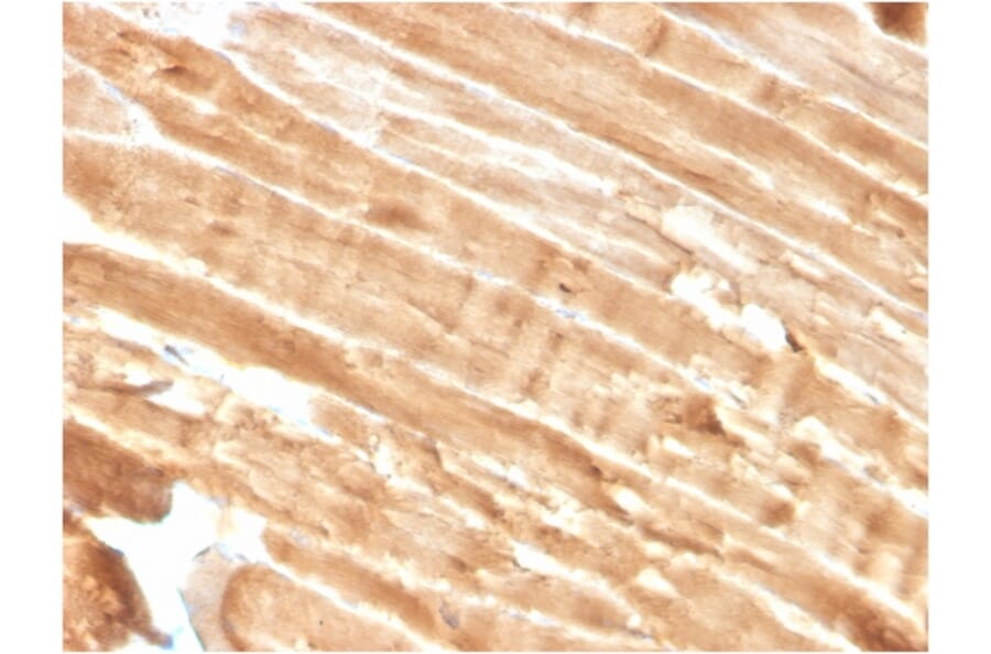 Immunohistochemistry - Anti-Dystrophin Antibody [DMD/3244] - BSA and Azide free (A251525) - Antibodies.com