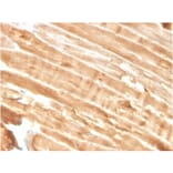 Immunohistochemistry - Anti-Dystrophin Antibody [DMD/3244] - BSA and Azide free (A251525) - Antibodies.com