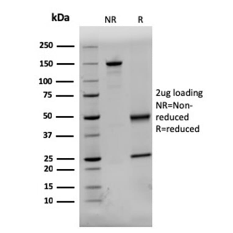 SDS-PAGE - Anti-Dystrophin Antibody [DMD/3244] - BSA and Azide free (A251525) - Antibodies.com