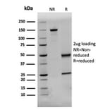 SDS-PAGE - Anti-Dystrophin Antibody [DMD/3244] - BSA and Azide free (A251525) - Antibodies.com