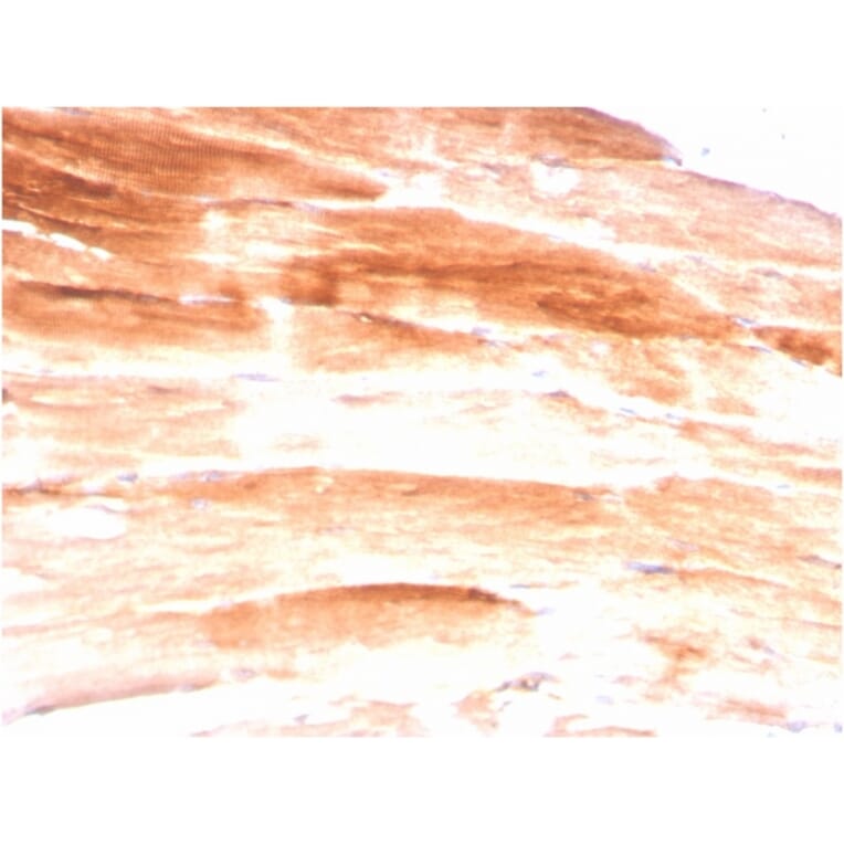 Immunohistochemistry - Anti-Dystrophin Antibody [DMD/3245] - BSA and Azide free (A251526) - Antibodies.com