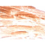 Immunohistochemistry - Anti-Dystrophin Antibody [DMD/3245] - BSA and Azide free (A251526) - Antibodies.com