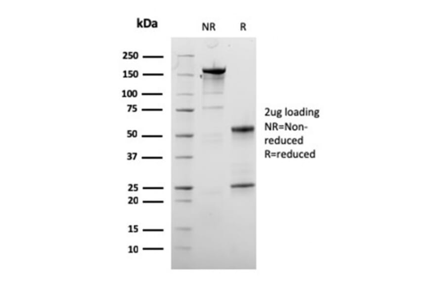 SDS-PAGE - Anti-Dystrophin Antibody [DMD/3245] - BSA and Azide free (A251526) - Antibodies.com