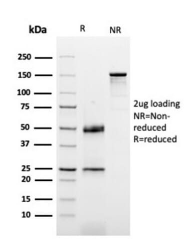 Anti-Dystrophin Antibody [DMD/3677] (A251527) | Antibodies.com