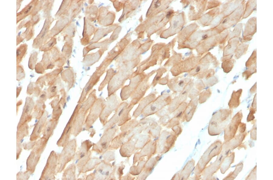 Immunohistochemistry - Anti-Dystrophin Antibody [DMD/3677] - BSA and Azide free (A251526) - Antibodies.com