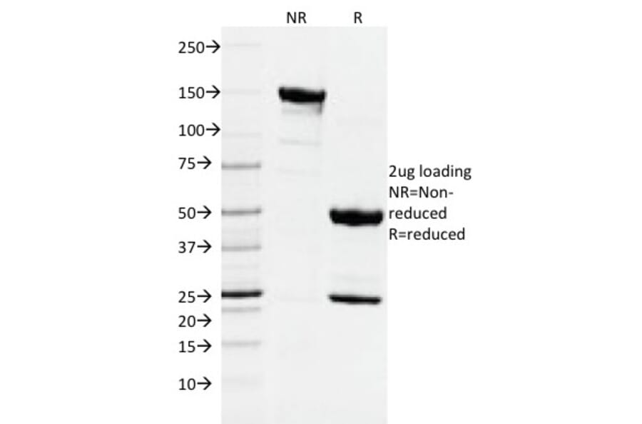 SDS-PAGE - Anti-DNMT1 Antibody [DNMT1/2061] - BSA and Azide free (A251528) - Antibodies.com