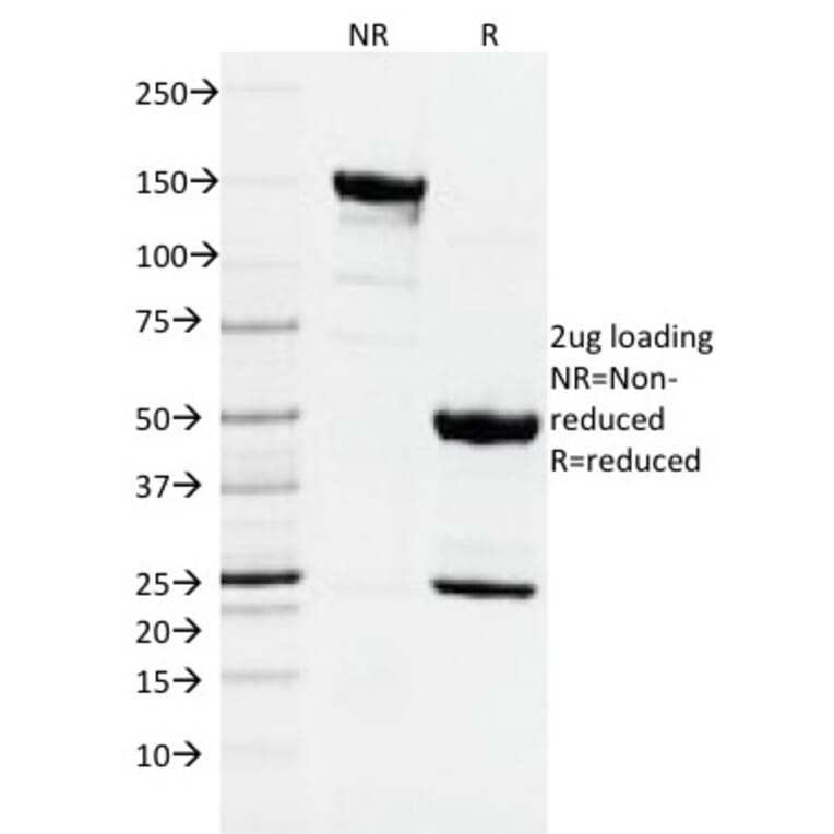 SDS-PAGE - Anti-DNMT1 Antibody [DNMT1/2061] - BSA and Azide free (A251528) - Antibodies.com