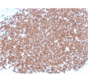 Immunohistochemistry - Anti-TdT Antibody [TDT/1393] - BSA and Azide free (A251530) - Antibodies.com