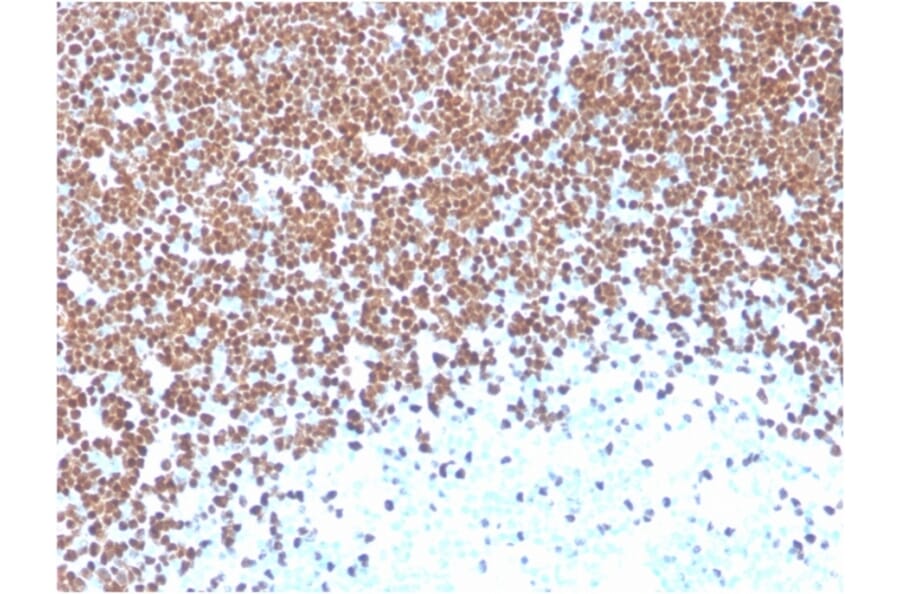 Immunohistochemistry - Anti-TdT Antibody [TDT/1393] - BSA and Azide free (A251530) - Antibodies.com