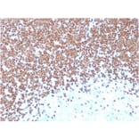 Immunohistochemistry - Anti-TdT Antibody [TDT/1393] - BSA and Azide free (A251530) - Antibodies.com