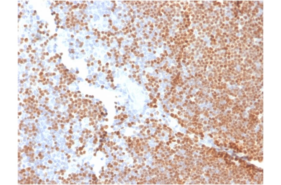 Immunohistochemistry - Anti-TdT Antibody [DNTT/1453] - BSA and Azide free (A251531) - Antibodies.com